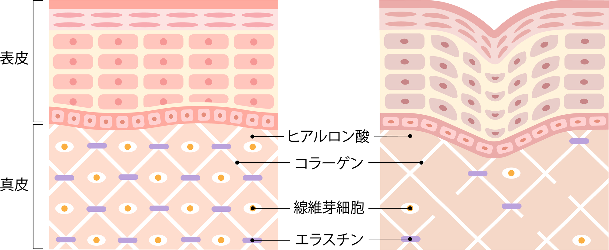 肌のエイジング